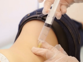 Лечение активным кислородом