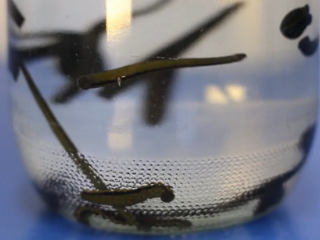 Что такое гирудотерапия?