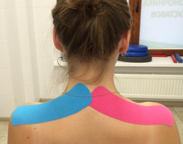 Кинезиотейпирование. Современная технология в ортопедии и травматологии.